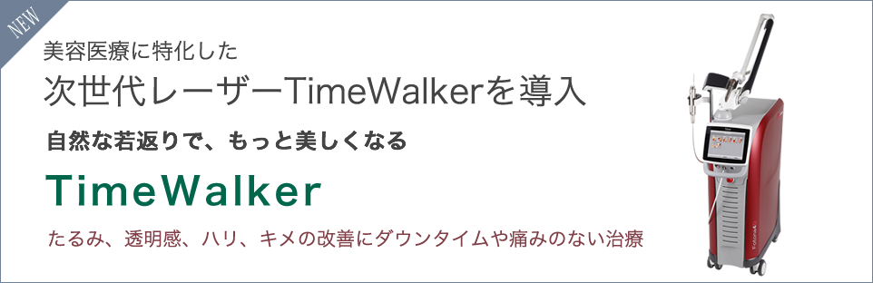 TimeWalker